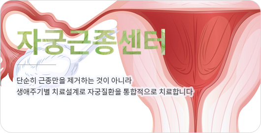 �ڱñ�������